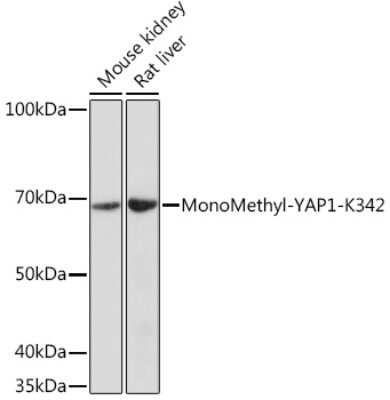 Western Blot: YAP1 [Monomethyl Lys342] AntibodyAzide and BSA Free [NBP3-15578]